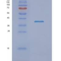 人NDUFAF1重组蛋白