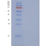 人NDUFV3重组蛋白