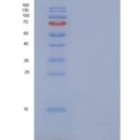 人NDUFV3重组蛋白