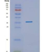 人NMNAT1重组蛋白