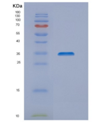 人NIPSNAP1重组蛋白