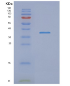 人NDUFAF1重组蛋白