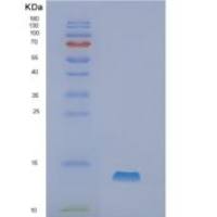 人Neurokinin B重组蛋白