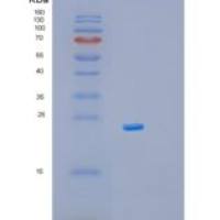 小鼠肌球蛋白轻链9(MYL9)重组蛋白