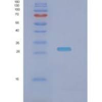 人NADH脱氢酶【泛醌】铁硫蛋白3,线粒体(NDUFS3)重组蛋白
