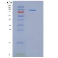 大鼠神经纤维网蛋白1(NRP1)重组蛋白