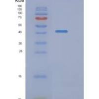 人N-乙酰神经氨酰酸合酶(NANS)重组蛋白