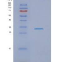 人NUBP2重组蛋白