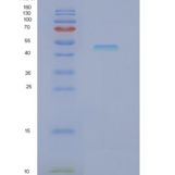 人酪氨酸激酶衔接蛋白非催化区1(NCK1)重组蛋白