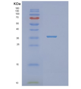 人NTHL1重组蛋白