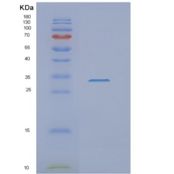 人NSMCE1重组蛋白