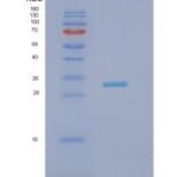 人NECAP2重组蛋白