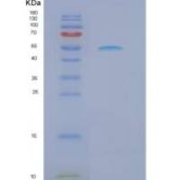 小鼠自然细胞毒性触发受体1(NCR1)重组蛋白