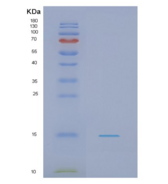 人NADH脱氢酶【泛醌】铁硫蛋白5重组蛋白