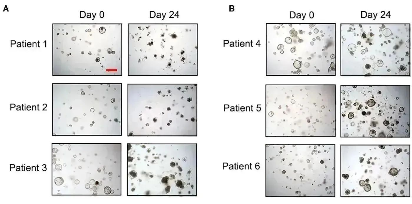 回顾2023年类器官研究进展，分享3D类器官研究解决方案