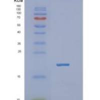 人成神经细胞瘤抑制瘤变蛋白1(NBL1)重组蛋白