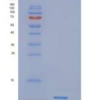 人NDUFB4重组蛋白