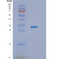 人N-乙酰神经氨酰酸磷酸酶(NANP)重组蛋白