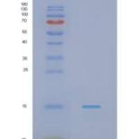 人NADH脱氢酶【泛醌】铁硫蛋白4,线粒体(NDUFS4)重组蛋白