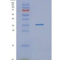 人N-乙酰转移酶1(NAT1)重组蛋白