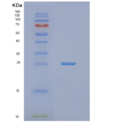 人线粒体-5'-核苷酸酶(NT5M)重组蛋白