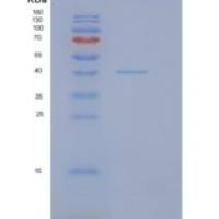 人NDEL1重组蛋白