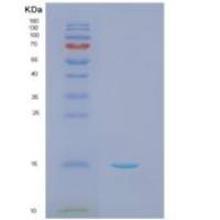 人自然细胞毒性触发受体2(NCR2)重组蛋白