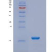 人NHP2L1重组蛋白