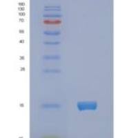 人自然细胞毒性触发受体3(NCR3)重组蛋白