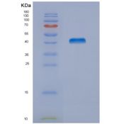 小鼠核连蛋白2(NUCB2)重组蛋白