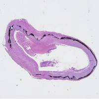 Von Kossa染色实验服务