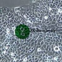 A-431细胞、A431人皮肤基底细胞癌细胞