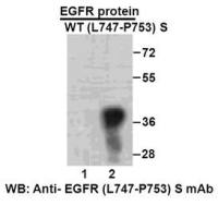EGFR (L747-P753)S