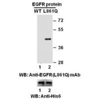 EGFR(L861Q)