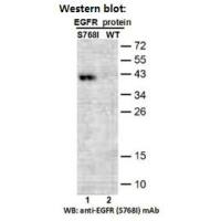 EGFR(S768I)
