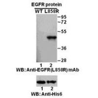EGFR(L858R)