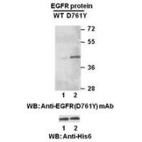 EGFR(D761Y)