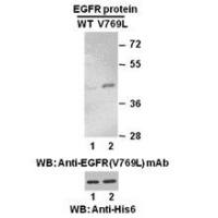 EGFR(V769L)