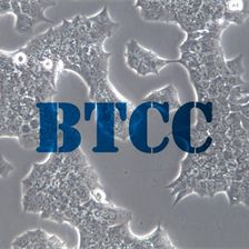 BT474人乳腺癌细胞