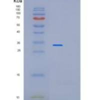 人PARVA重组蛋白