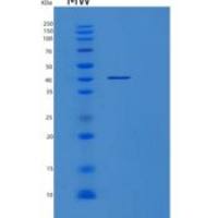 人8-羟基鸟嘌呤糖苷酶1(OGG1)重组蛋白