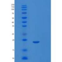 人视网膜视杆视紫红质敏感的cGMP 3’,5’-环磷酸二酯酶亚单位δ(PDE6D)重组蛋白