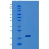 人ORAOV1重组蛋白