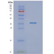 人NUDT9重组蛋白