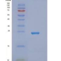 人NUDT16重组蛋白