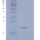 人NUDT2重组蛋白