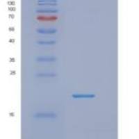 人NUDT2重组蛋白