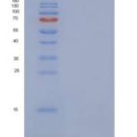 人PET117重组蛋白