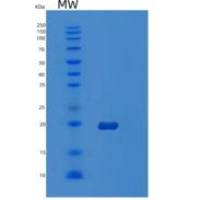 人含卵巢癌免疫反应抗原域蛋白2(OCIAD2)重组蛋白