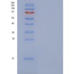 人血小板因子4V1(PF4V1)重组蛋白